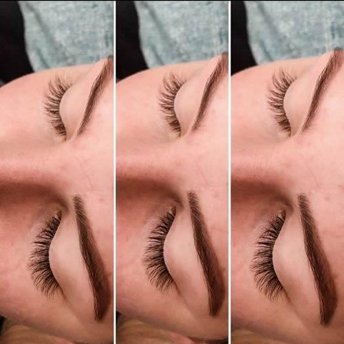 Before and after brow treatment